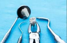 Dental Surgery